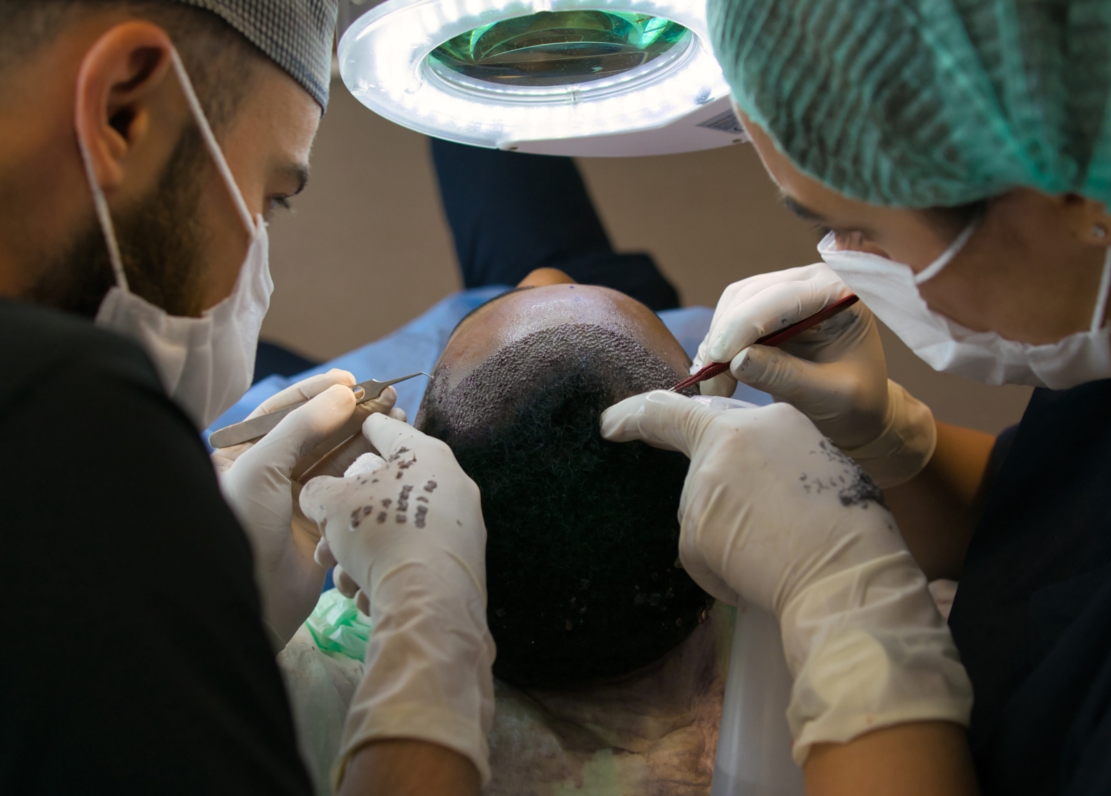 Best Turkish Hair Transplant Clinics Dubai