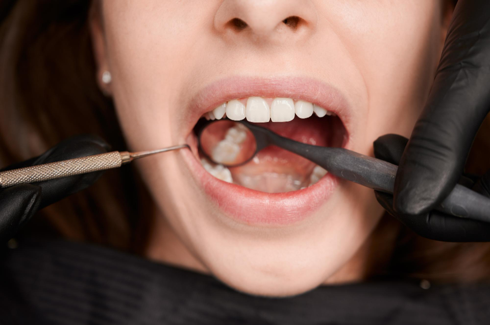 7 Secrets Periodontists in Dubai Use to Reverse Gum Recession | Plaza Clinic