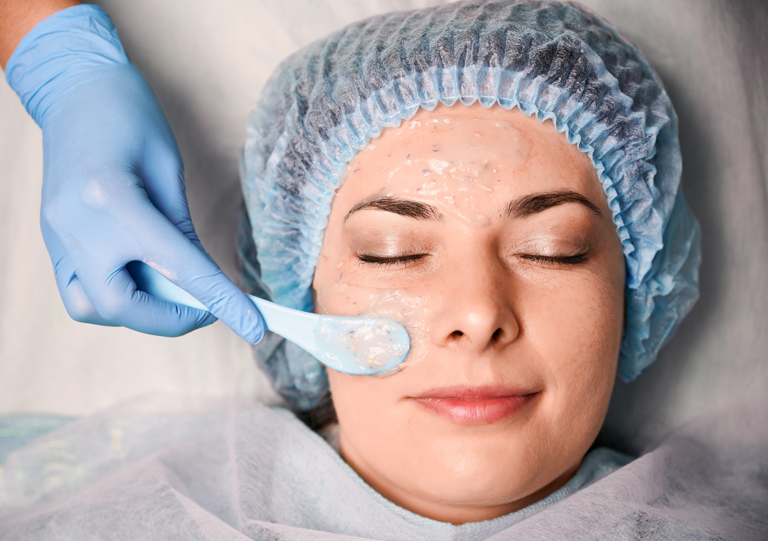 Best professional chemical peel procedure at skincare clinic